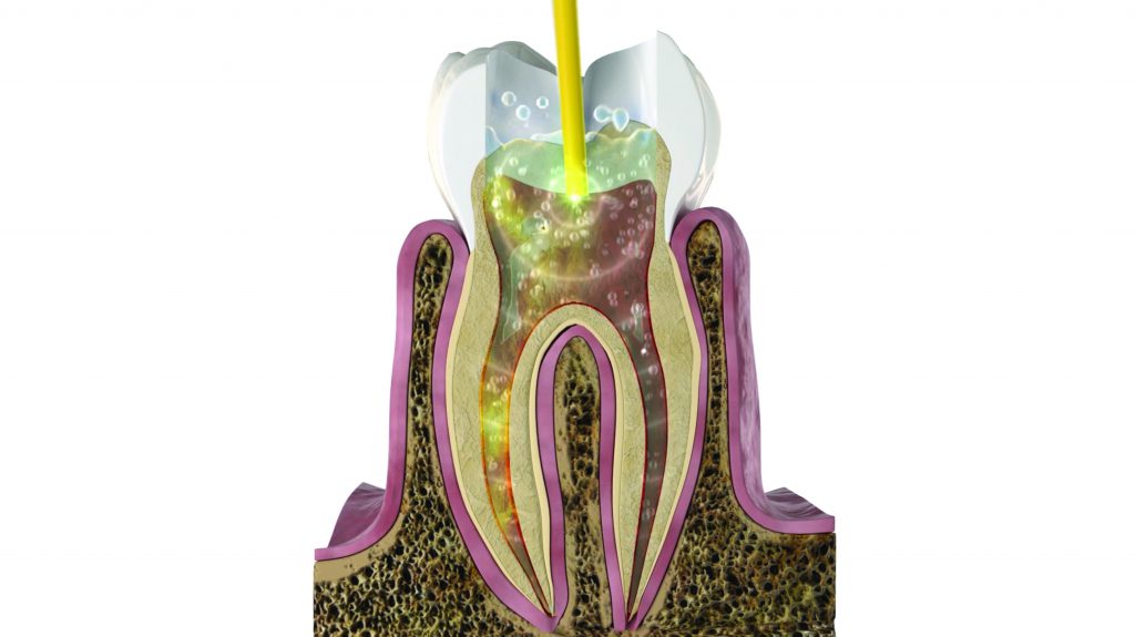 Advanced Technology Aether Endo Integrative & Contemporary Endodontics
